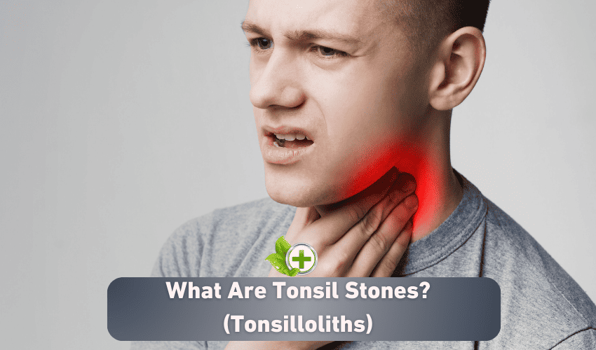 What Are Tonsil Stones? (Tonsilloliths) - Ulti Health Guide