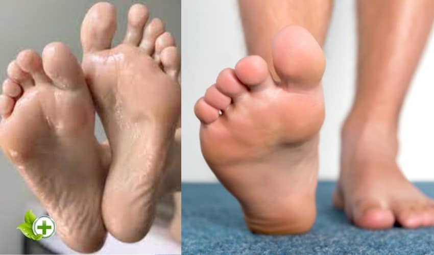 2 pairs of sweaty feet in a post about Foot Skin Peeling
