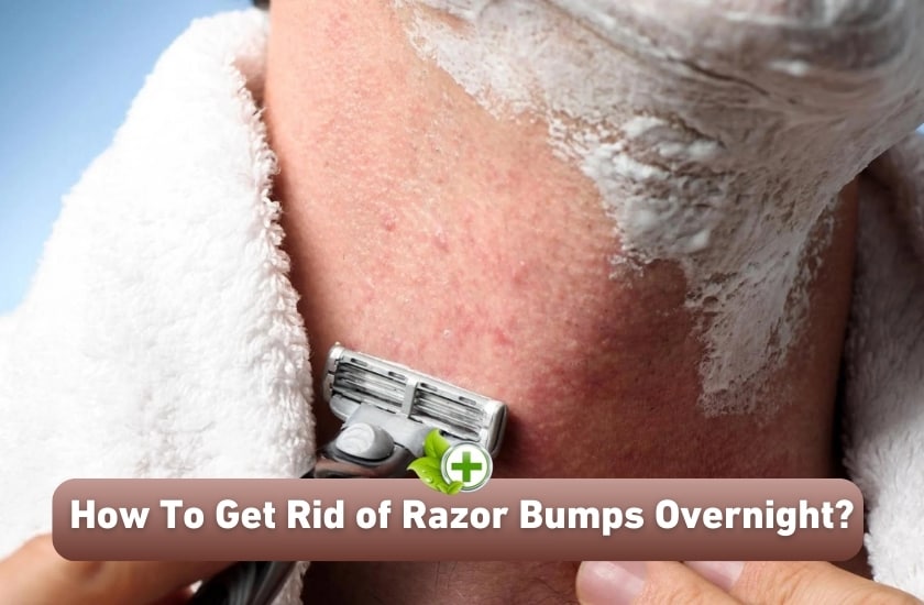 Bumpy Skin From Razor How To Get Rid of Razor Bumps Overnight?